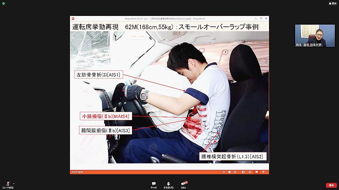 医工連携でEDRデータを活用し人体傷害を詳細解析(日本大学、日本医科大学千葉北総病院)